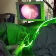Operatia de prostata cu Laser verde