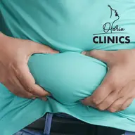 Abdominoplastie