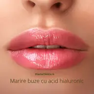 Diferenta dintre acid hialuronic si Botox