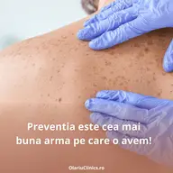 Importanța controlului anual la medicul dermatolog
