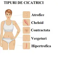 Tipuri de cicatrici și ce soluții de tratament există