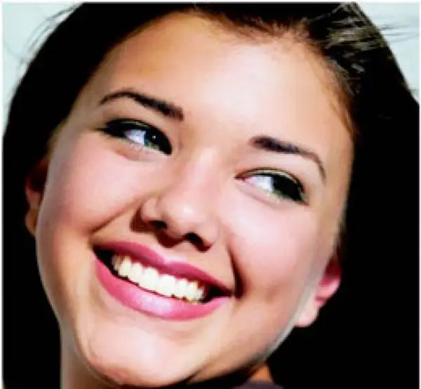 Cele mai importante proceduri care tin de estetica dentara