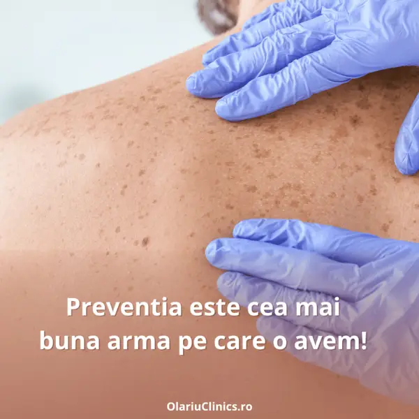Importanța controlului anual la medicul dermatolog