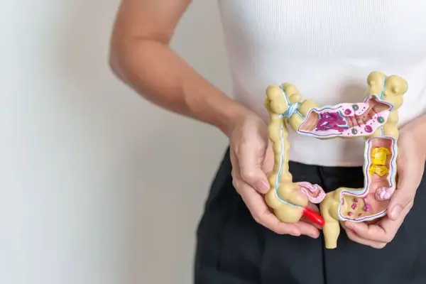 Cele mai comune complicații ale bolii Crohn și cum să le previi
