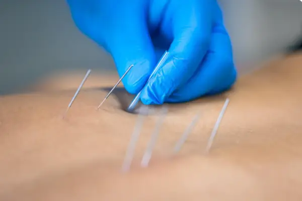 Când durerea nu trece singură: soluția pe care o oferă Kinetic Impact