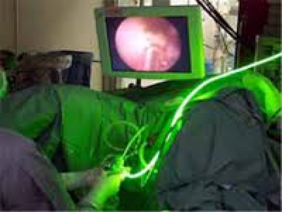 Operatia de prostata cu Laser verde