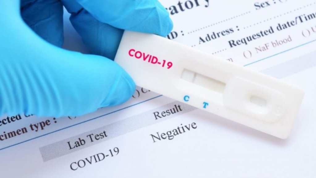 De ce este indicat sa te testezi pentru Coronavirus?